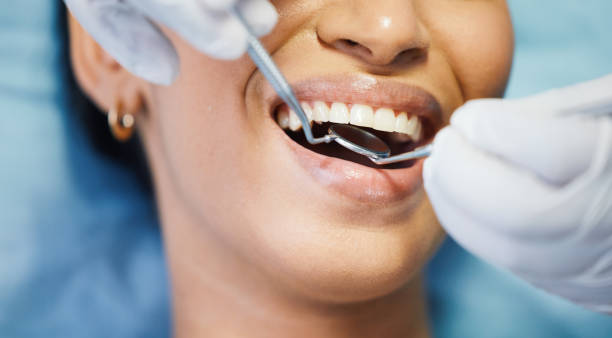 Best Broken or Cracked Tooth Emergency Dentist in Harvest, AL