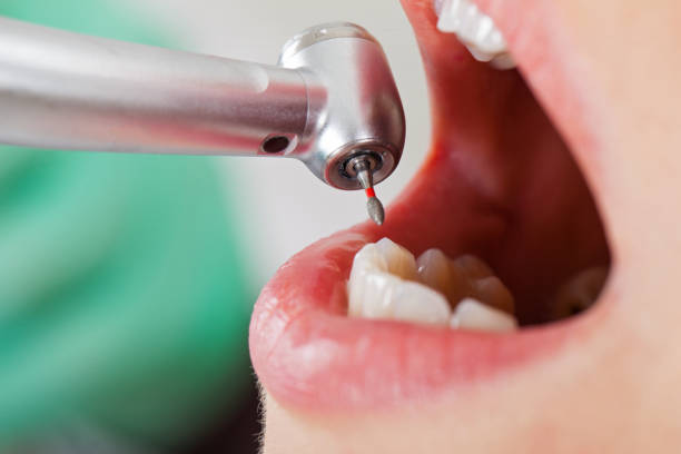Best Emergency Dental Care for Abscessed Tooth in Harvest, AL
